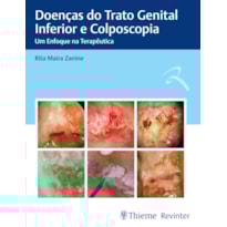 DOENÇAS DO TRATO GENITAL INFERIOR E COLPOSCOPIA: UM ENFOQUE NA TERAPÊUTICA