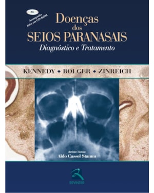 Doenças dos seios paranasais: diagnóstico e tratamento