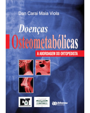 Doenças osteometabólicas: A abordagem do ortopedista