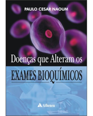 Doenças que alteram os exames bioquímicos