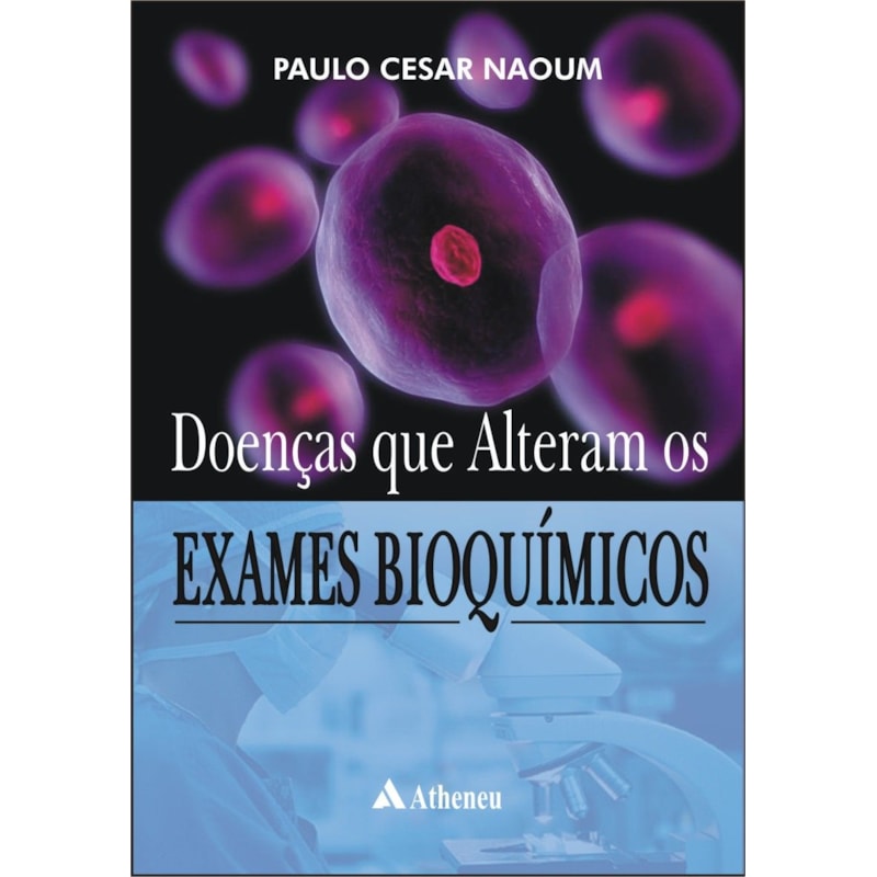 DOENÇAS QUE ALTERAM OS EXAMES BIOQUÍMICOS