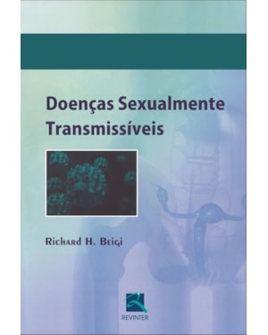 Doenças sexualmente transmissíveis