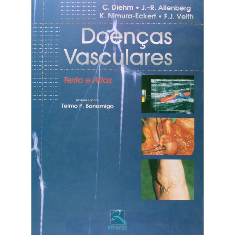 DOENÇAS VASCULARES