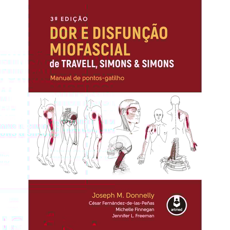 DOR E DISFUNÇÃO MIOFASCIAL DE TRAVELL, SIMONS & SIMONS: MANUAL DE PONTOS-GATILHO