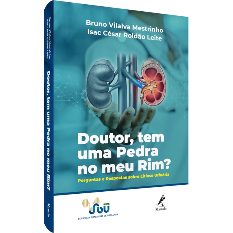 DOUTOR, TEM UMA PEDRA NO MEU RIM?: PERGUNTAS E RESPOSTAS SOBRE LITÍASE URINÁRIA