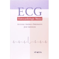 ECG ELETROCARDIOLOGIA BÁSICA
