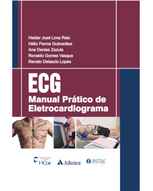 ECG: manual prático de eletrocardiograma