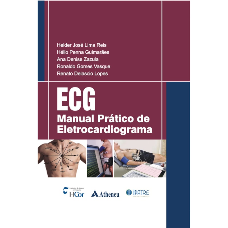 ECG: manual prático de eletrocardiograma