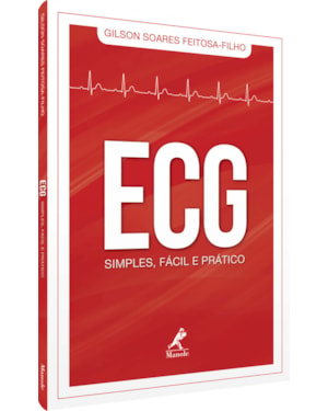 ECG simples, fácil e prático