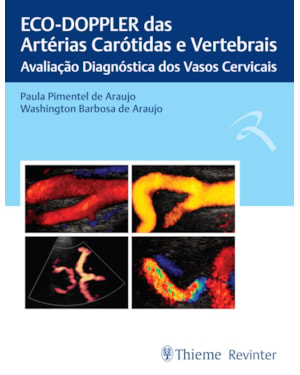 Eco-Doppler das artérias carótidas e vertebrais: avaliação diagnóstica dos vasos cervicais