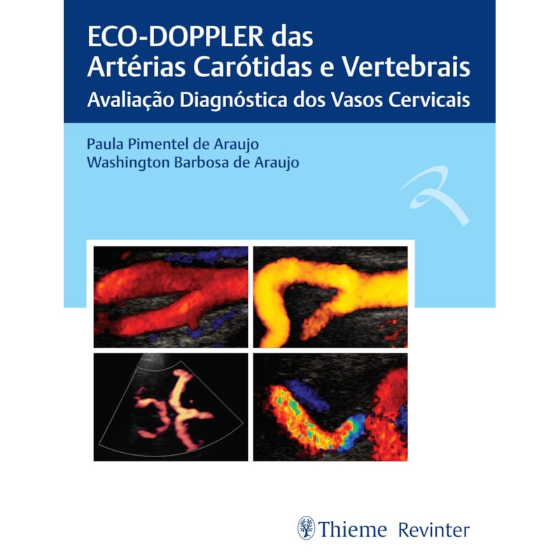 ECO-DOPPLER DAS ARTÉRIAS CARÓTIDAS E VERTEBRAIS: AVALIAÇÃO DIAGNÓSTICA DOS VASOS CERVICAIS