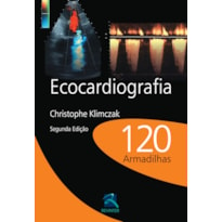 ECOCARDIOGRAFIA: 120 ARMADILHAS