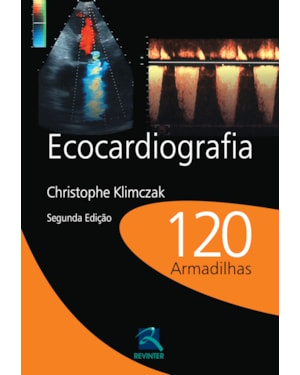 Ecocardiografia: 120 armadilhas
