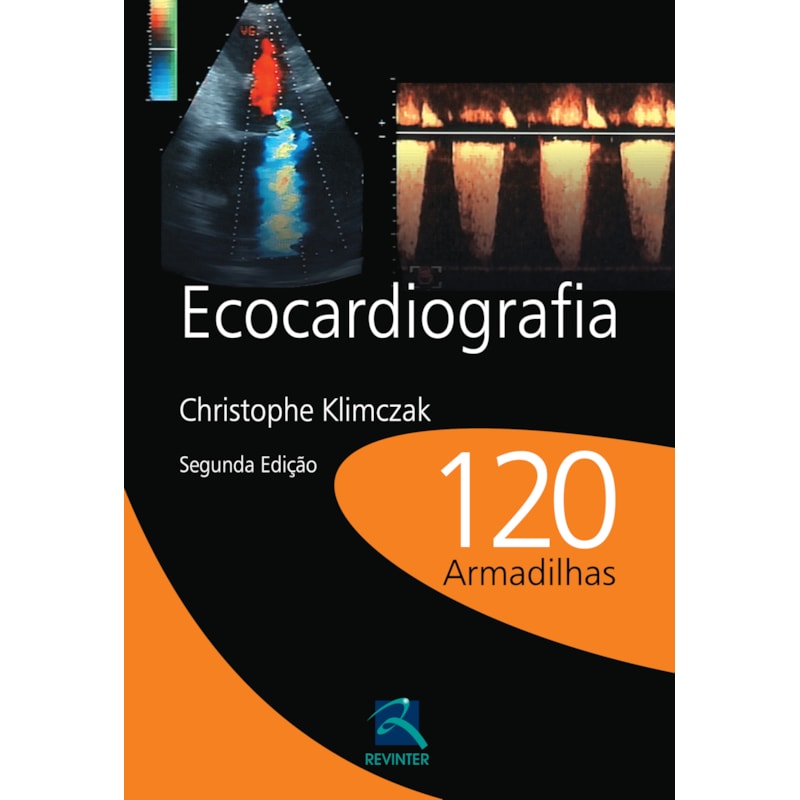 ECOCARDIOGRAFIA: 120 ARMADILHAS