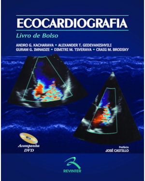 Ecocardiografia