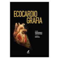 ECOCARDIOGRAFIA ECOCARDIOGRAFIA
