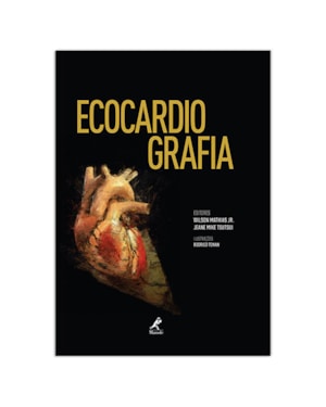 Ecocardiografia