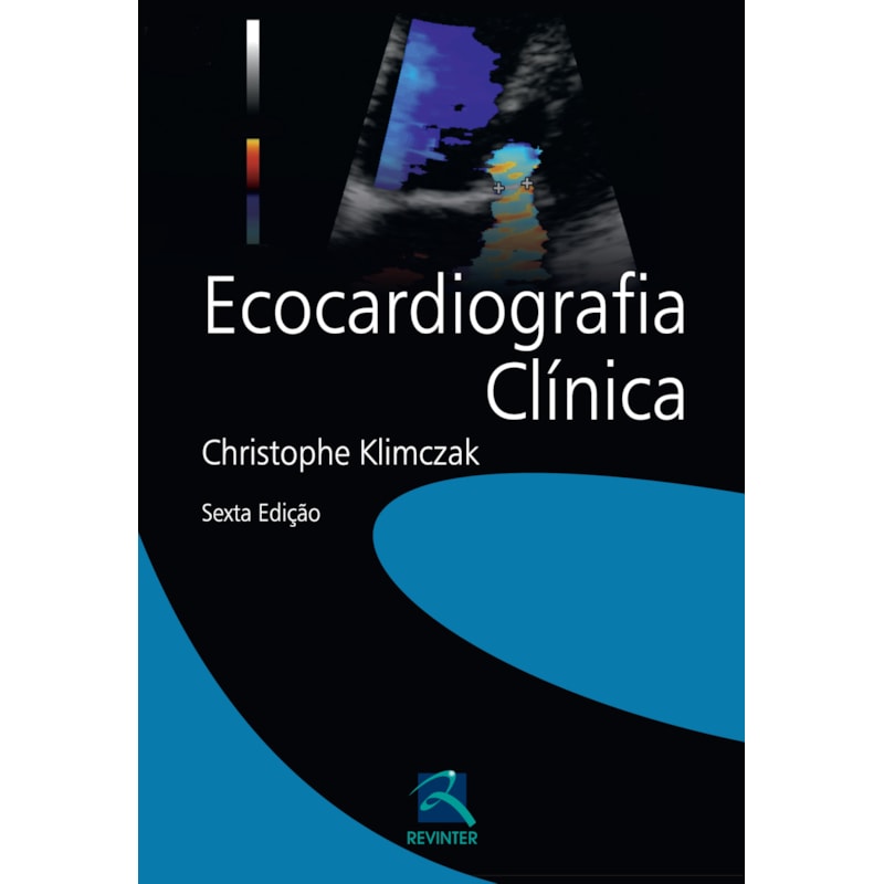 ECOCARDIOGRAFIA CLÍNICA