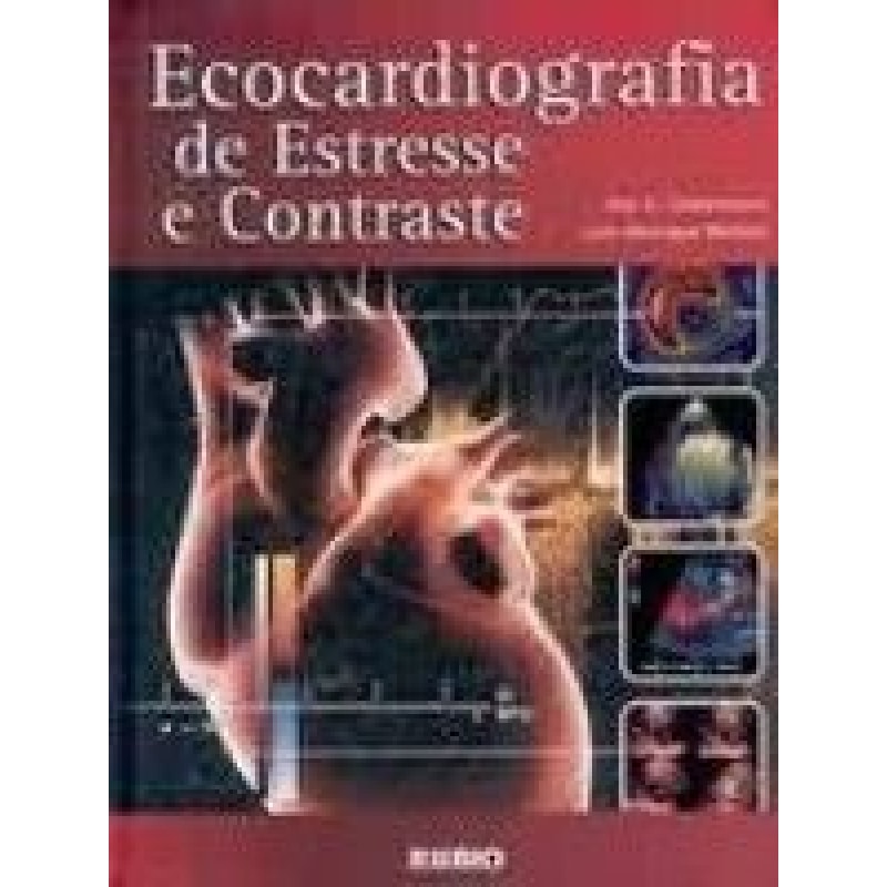 Ecocardiografia de estresse e contraste c/ cd-rom