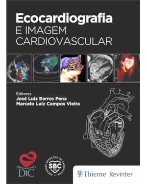 Ecocardiografia e imagem cardiovascular
