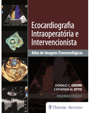 Ecocardiografia intraoperatória e intervencionista: atlas de imagens transesofágicas
