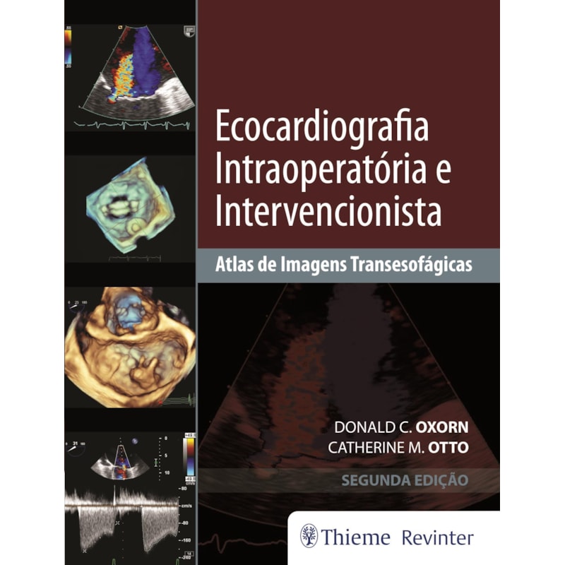Ecocardiografia intraoperatória e intervencionista: atlas de imagens transesofágicas