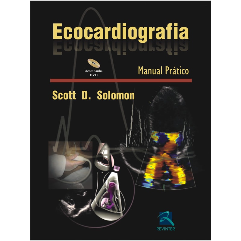 ECOCARDIOGRAFIA: MANUAL PRÁTICO