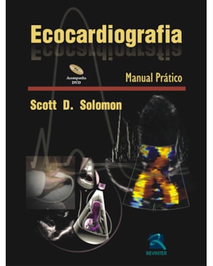 Ecocardiografia: manual prático