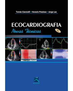 Ecocardiografia: novas técnicas