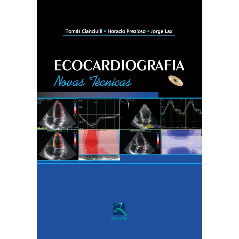 Ecocardiografia: novas técnicas