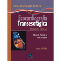 ECOCARDIOGRAFIA TRANSESOFÁGICA