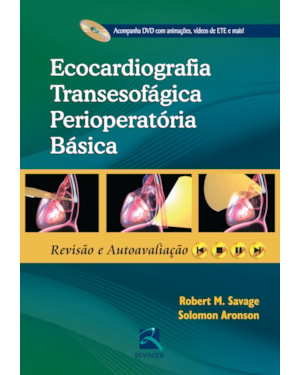 Ecocardiografia transesofágica perioperatória básica: revisão e autoavaliação