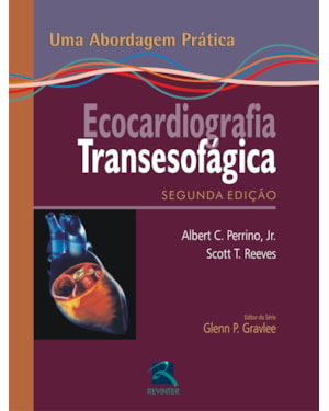 Ecocardiografia transesofágica: uma abordagem prática