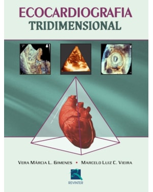 Ecocardiografia tridimensional