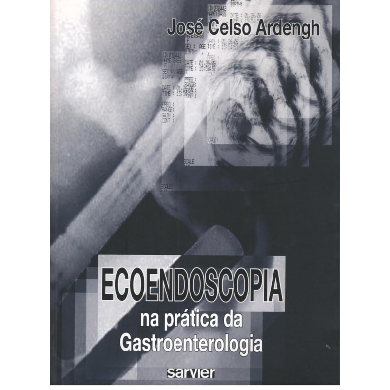 ECOENDOSCOPIA NA PRÁTICA DA GASTROENTEROLOGIA