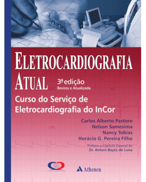 Eletrocardiografia atual