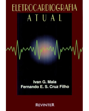 ELETROCARDIOGRAFIA ATUAL