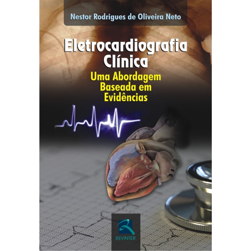 ELETROCARDIOGRAFIA CLÍNICA: UMA ABORDAGEM BASEADA EM EVIDÊNCIAS