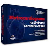ELETROCARDIOGRAMA NA SÍNDROME CORONÁRIA AGUDA