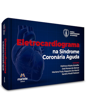 Eletrocardiograma na síndrome coronária aguda