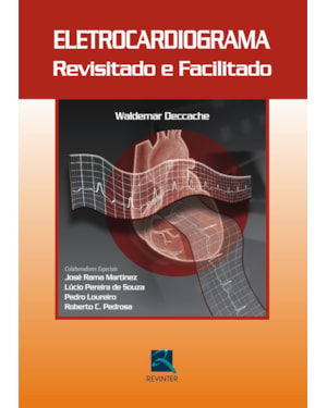 Eletrocardiograma revisitado e facilitado