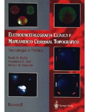 ELETROENCEFALOGRAFIA CLÍNICA E MAPEAMENTO CEREBRAL