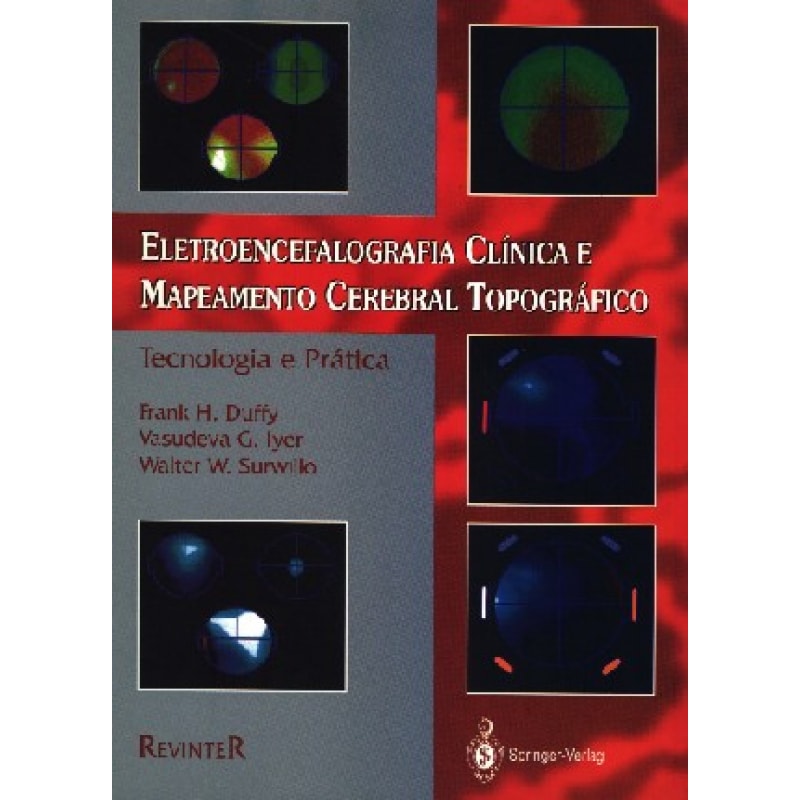 ELETROENCEFALOGRAFIA CLÍNICA E MAPEAMENTO CEREBRAL