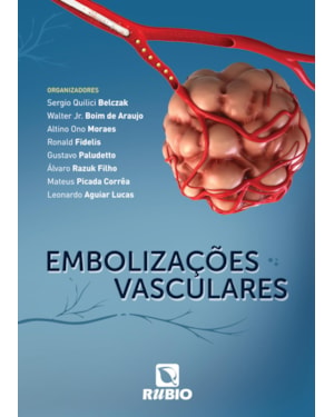 Embolizações vasculares