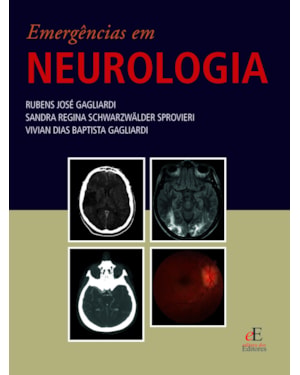EMERGENCIAS EM NEUROLOGIA
