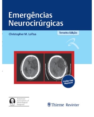 Emergências neurocirúrgicas