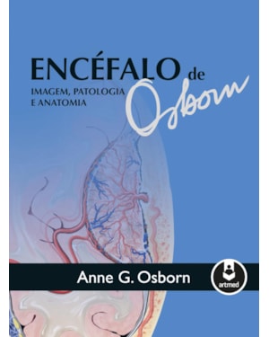 ENCÉFALO DE OSBORN: IMAGEM, PATOLOGIA E ANATOMIA