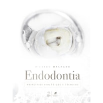 ENDODONTIA - PRINCÍPIOS BIOLÓGICOS E TÉCNICOS