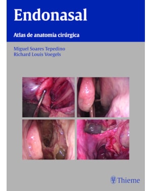 Endonasal: atlas de anatomia cirúrgica