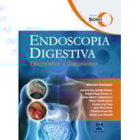Endoscopia digestiva: diagnóstico e tratamento